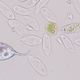 Illustration for article titled Aggressive Flagellate Just Going Around Whipping Other Single-Celled Organisms